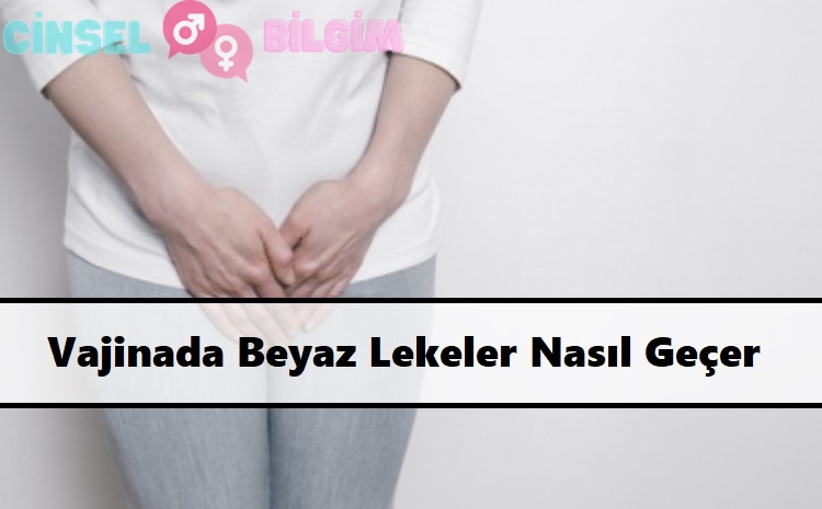 Vajinada Beyaz Lekeler Nasıl Geçer